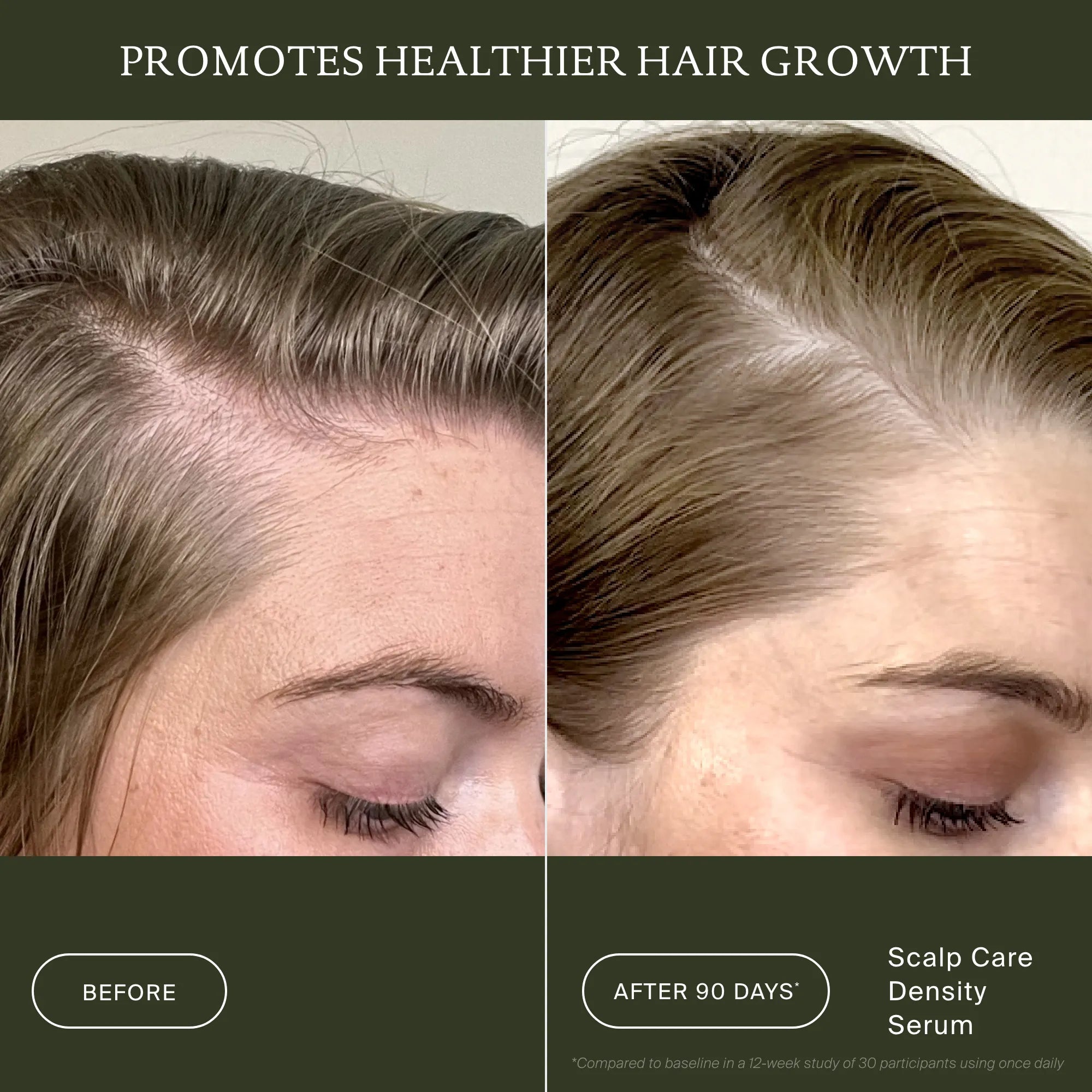 Scalp Care Density Serum 3-Pack - Image 4